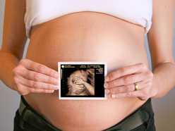 Pregnant mom holding 3D ultrasound
